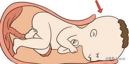 宝宝娩出后医生必做的检查，你知道几个？