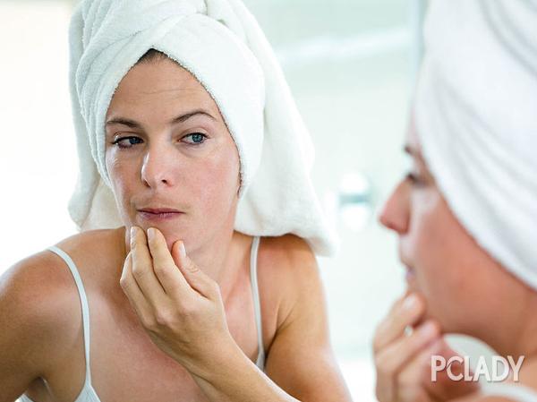 美容护肤小常识 痤疮是什么？