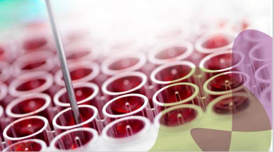 日本研究人员利用血液微核糖核酸筛查卵巢癌，灵敏度达99％