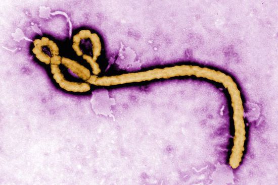 资料图片：埃博拉病毒