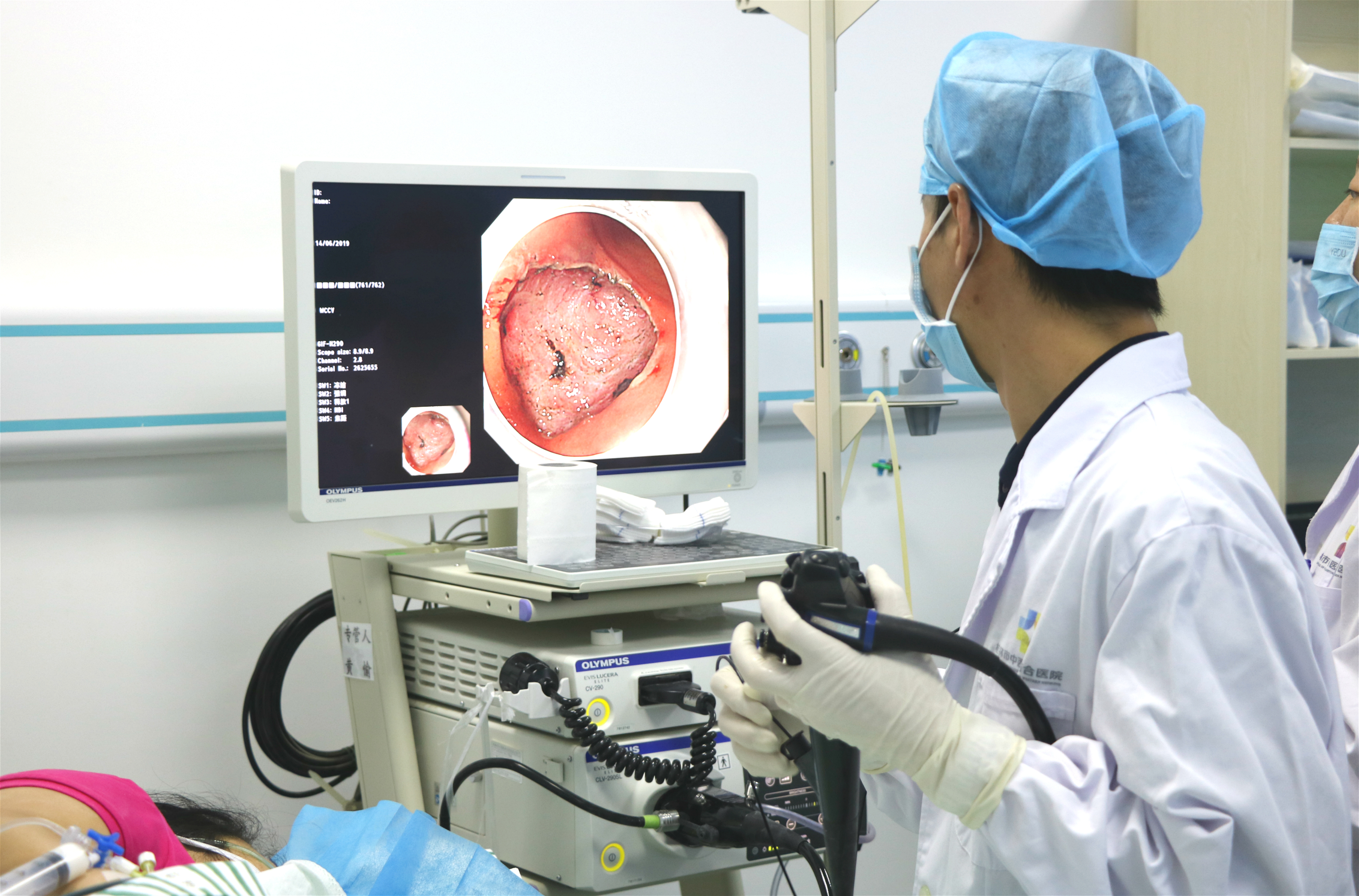 市中西医结合医院成功实施第一例胃窦早癌内镜下黏膜剥离术