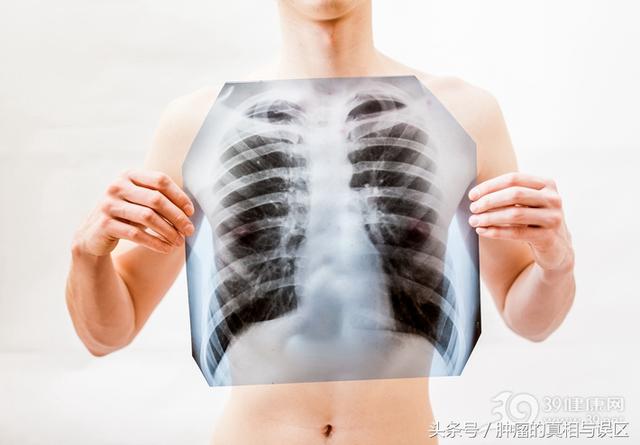 胸外科主任：有这4种病赶紧戒烟，下一个找你的可能是肺癌
