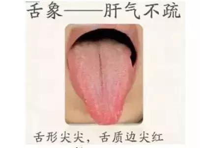 舌诊图谱，中医看舌头到底都在看什么？教你自己认识舌图