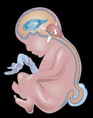 揭秘小儿神经管畸形的元凶，让你孕育健康宝宝