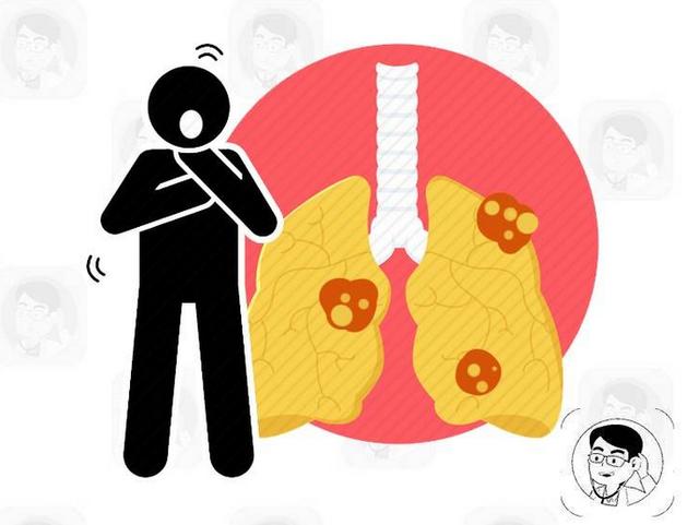 如何知道一个人的肺是否健康？从3个地方就能看出来，瞒不住