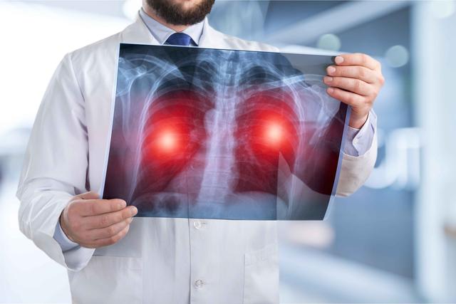 如何知道一个人的肺是否健康？从3个地方就能看出来，瞒不住
