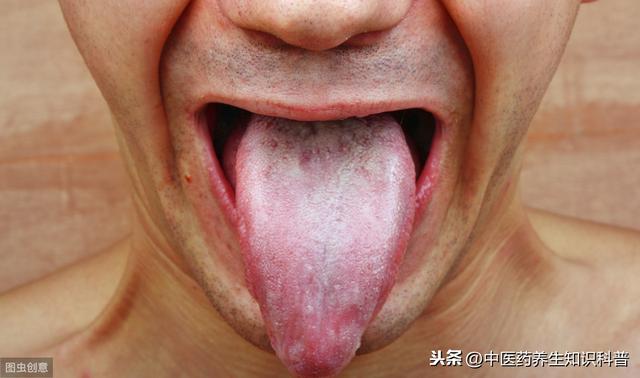 医生：看舌头知健康，中医教你如何察看舌苔、认知疾病？
