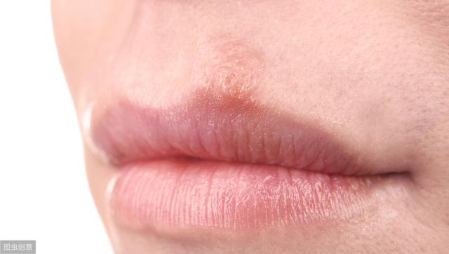 中医是如何通过唇色知道身体健康的