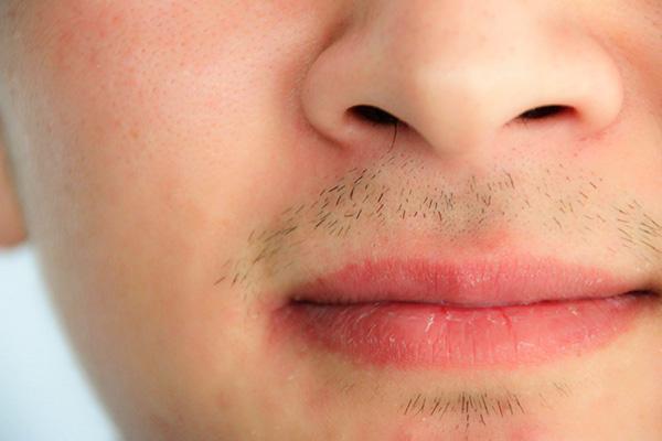 男性长胡子的速度和什么有关？胡子长得快是好事儿？