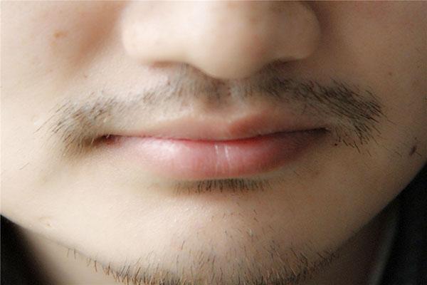 男性胡子长得快，原来和“它”有关！如果你也是，值得祝贺