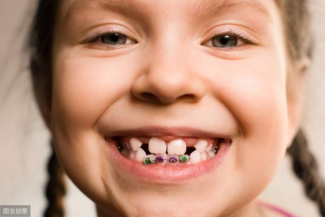 儿童换牙期这些不良习惯，直接导致牙齿不齐，家长们要注意了