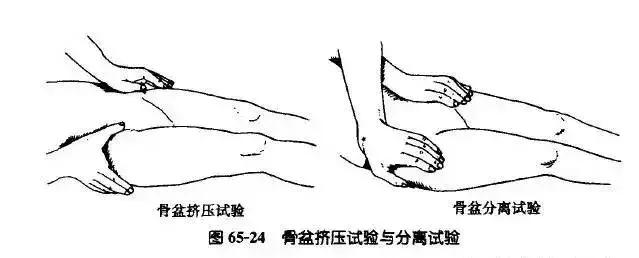 中医骨科特殊诊断法——非常珍贵！