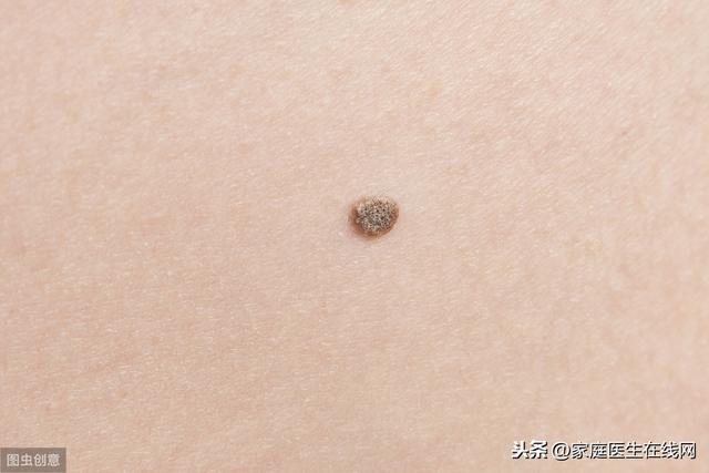 皮肤有5个迹象，或是癌细胞正在“入侵”！不是普通的皮肤病