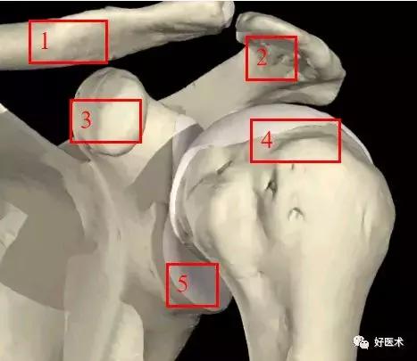 肩关节损伤的影像学诊断技巧，必点收藏